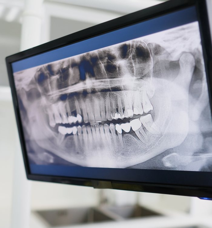 Dental Cleanings & Exams — Century City dental care