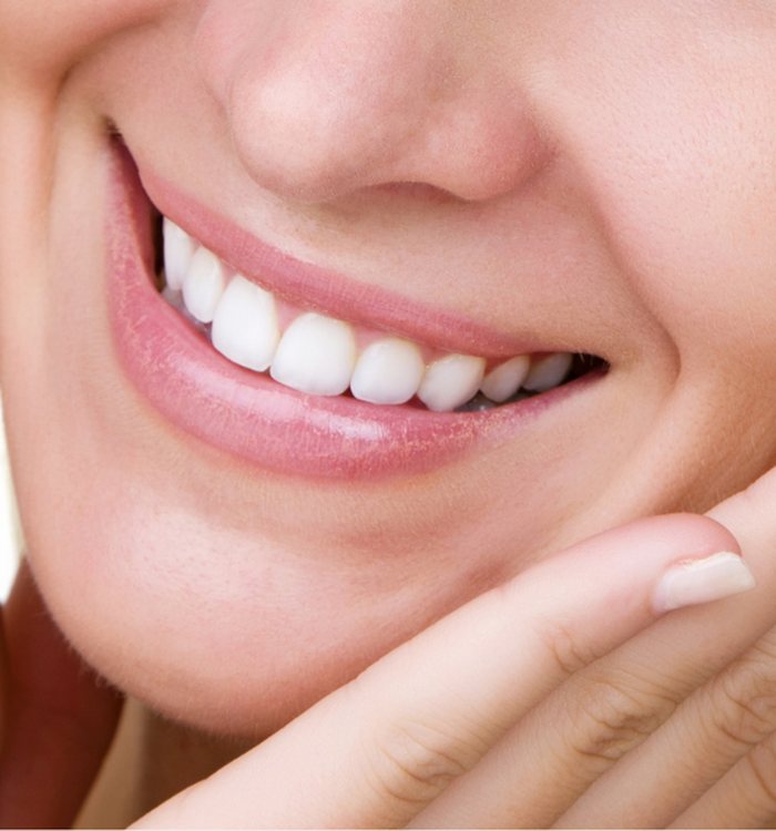 Smile Makeover — Century City dental care